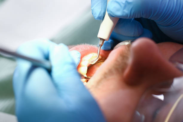 Best Weekend Emergency Dental Services in San Marcos, TX