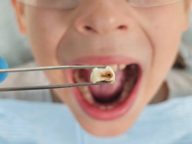 Best Emergency Denture Repair in San Marcos, TX